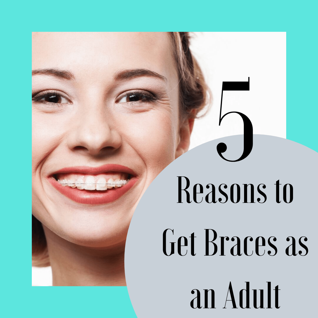 Title banner for "5 Reasons to Get Braces as an Adult"